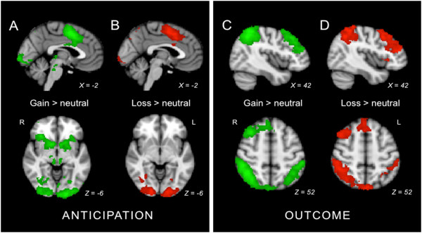 Increased default mode network activity in socially anxious individuals during reward processing.