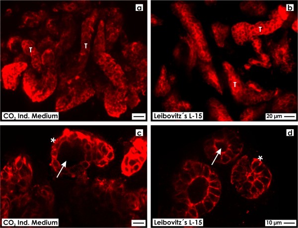 Tannic acid label indicates abnormal cell development coinciding with regeneration of renal tubules.