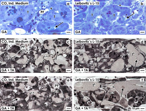 Tannic acid label indicates abnormal cell development coinciding with regeneration of renal tubules.