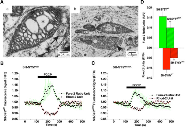 Selective vulnerability of motoneuron and perturbed mitochondrial calcium homeostasis in amyotrophic lateral sclerosis: implications for motoneurons specific calcium dysregulation.