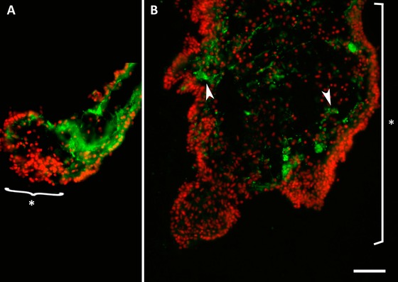 Temporal and spatial analysis of enteric nervous system regeneration in the sea cucumber Holothuria glaberrima.