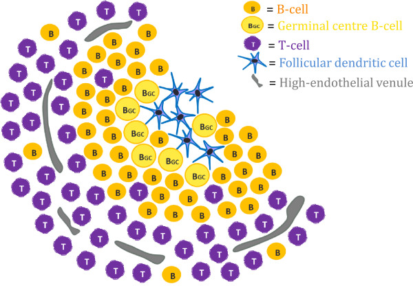 Characterisation and prognostic value of tertiary lymphoid structures in oral squamous cell carcinoma.