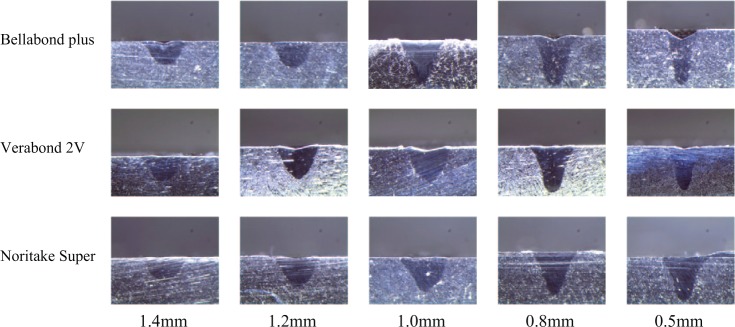 Observation of changes in the metallurgical characteristics of Ni-Cr alloys using Nd:YAG laser welding.