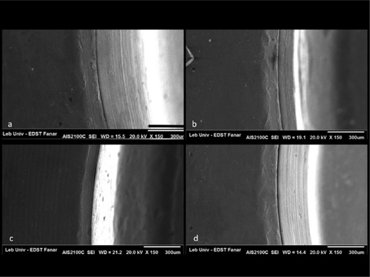 Leakage evaluation of original and compatible implant-abutment connections: In vitro study using Rhodamine B.