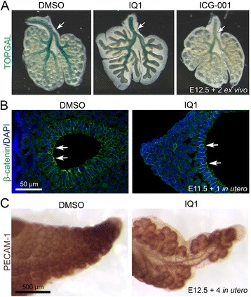 Inhibition of β-catenin/p300 interaction proximalizes mouse embryonic lung epithelium.