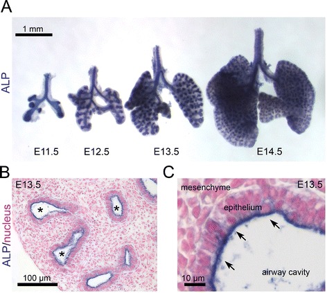 Inhibition of β-catenin/p300 interaction proximalizes mouse embryonic lung epithelium.