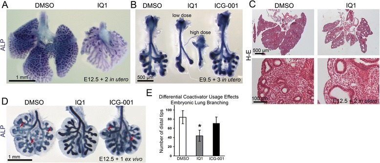 Inhibition of β-catenin/p300 interaction proximalizes mouse embryonic lung epithelium.