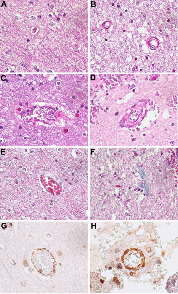 Ageing and microvasculature.