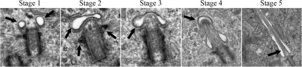 Ultrastructural characterization of primary cilia in pathologically characterized human glioblastoma multiforme (GBM) tumors.