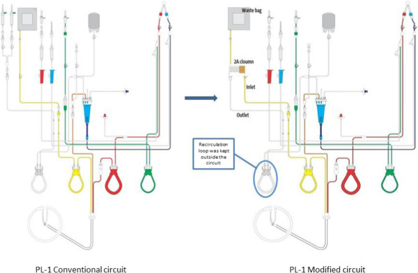 Cascade plasmapheresis (CP) as a preconditioning regime in ABO-incompatible live related donor liver transplants (ABOi-LDLT).