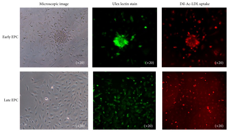 Determination of Early and Late Endothelial Progenitor Cells in Peripheral Circulation and Their Clinical Association with Coronary Artery Disease.