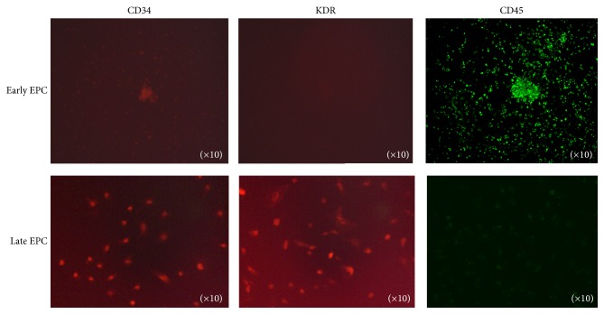 Determination of Early and Late Endothelial Progenitor Cells in Peripheral Circulation and Their Clinical Association with Coronary Artery Disease.