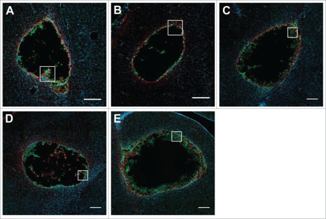 Cell infiltration into a 3D electrospun fiber and hydrogel hybrid scaffold implanted in the brain.