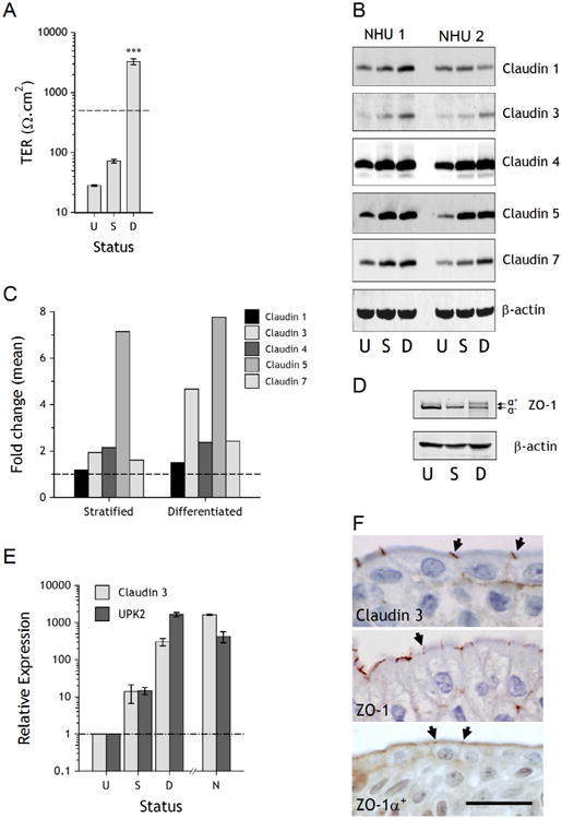 The human urothelial tight junction: claudin 3 and the ZO-1α<sup>+</sup> switch.