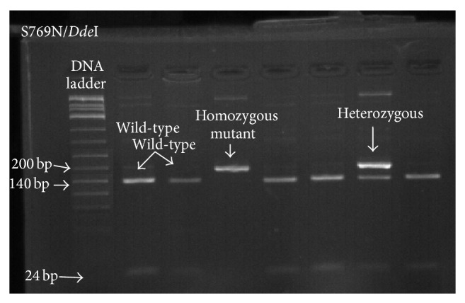 Occurrence of pfatpase6 Single Nucleotide Polymorphisms Associated with Artemisinin Resistance among Field Isolates of Plasmodium falciparum in North-Eastern Tanzania.