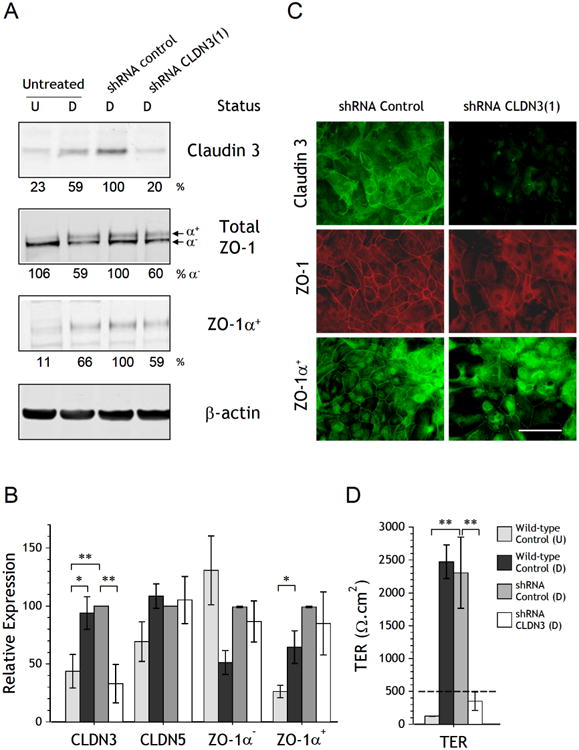 The human urothelial tight junction: claudin 3 and the ZO-1α<sup>+</sup> switch.