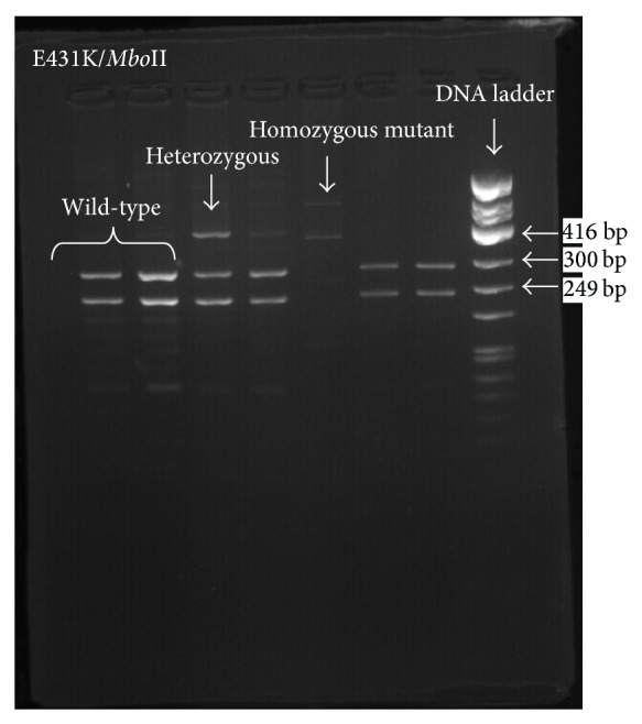 Occurrence of pfatpase6 Single Nucleotide Polymorphisms Associated with Artemisinin Resistance among Field Isolates of Plasmodium falciparum in North-Eastern Tanzania.