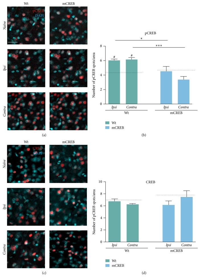 CREB Regulates Experience-Dependent Spine Formation and Enlargement in Mouse Barrel Cortex.