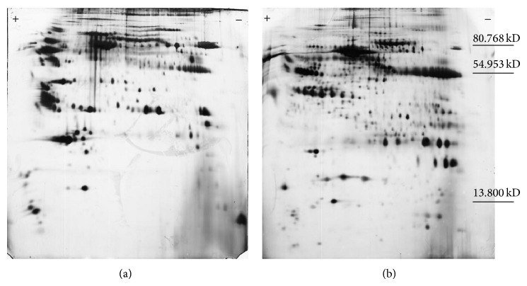 Comparative proteomic study reveals the molecular aspects of delayed ocular symptoms induced by sulfur mustard.