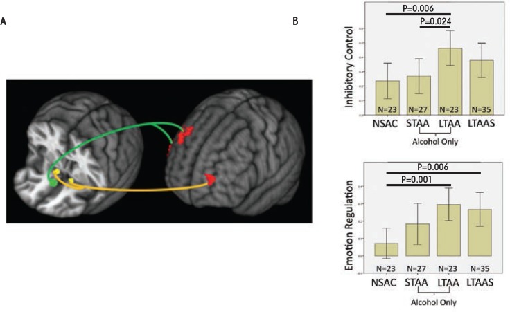 Neuroplasticity in Human Alcoholism: Studies of Extended Abstinence with Potential Treatment Implications.