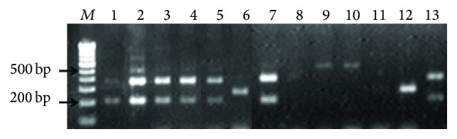 Prevalence of Virulence Factors and Drug Resistance in Clinical Isolates of Enterococci: A Study from North India.