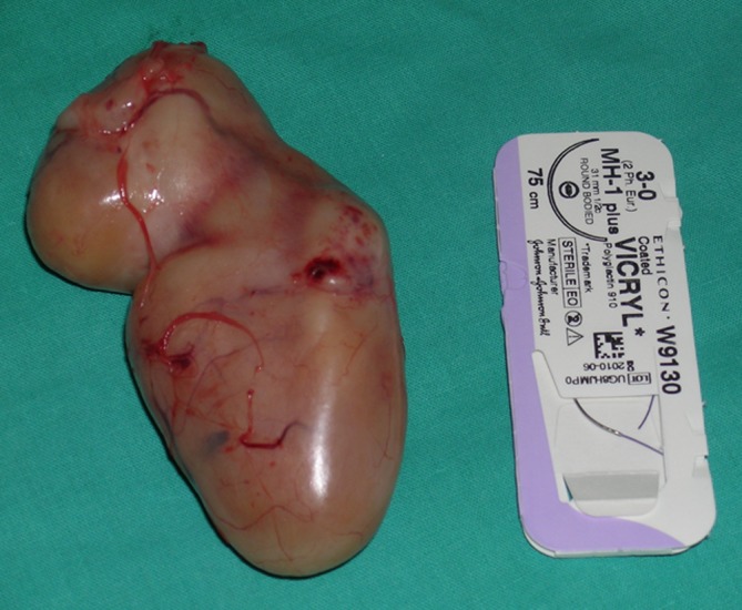 Statistical and histological analysis of tumors of the upper extremity.
