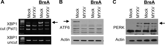 Myxoma virus attenuates expression of activating transcription factor 4 (ATF4) which has implications for the treatment of proteasome inhibitor-resistant multiple myeloma.