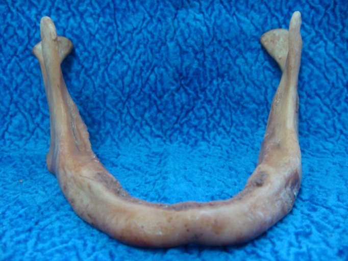 The comparison of the precision of different dental radiographic methods in mandibular peri-implantary measurements: an in vitro study.