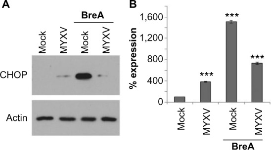 Myxoma virus attenuates expression of activating transcription factor 4 (ATF4) which has implications for the treatment of proteasome inhibitor-resistant multiple myeloma.