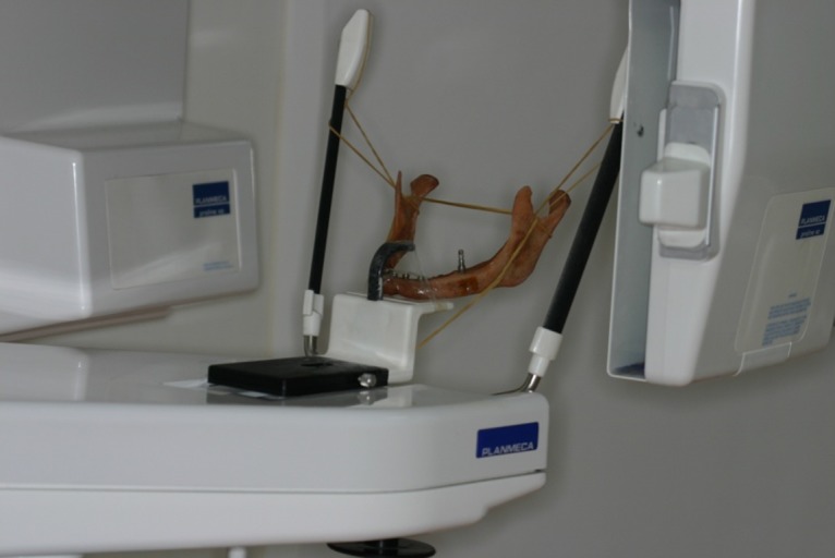 The comparison of the precision of different dental radiographic methods in mandibular peri-implantary measurements: an in vitro study.