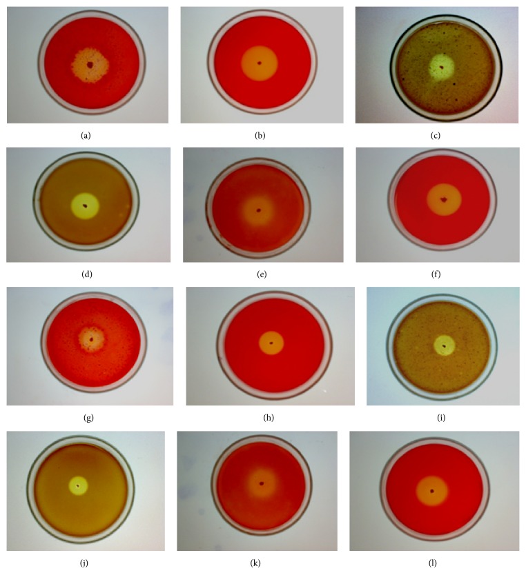 An efficient and improved methodology for the screening of industrially valuable xylano-pectino-cellulolytic microbes.