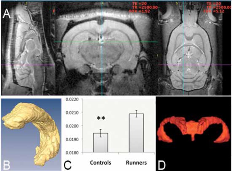 Hippocampal morphology in a rat model of depression: the effects of physical activity.