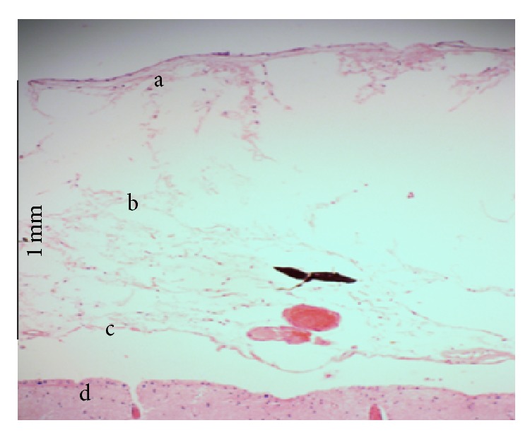 Histology and Morphology of the Brain Subarachnoid Trabeculae.