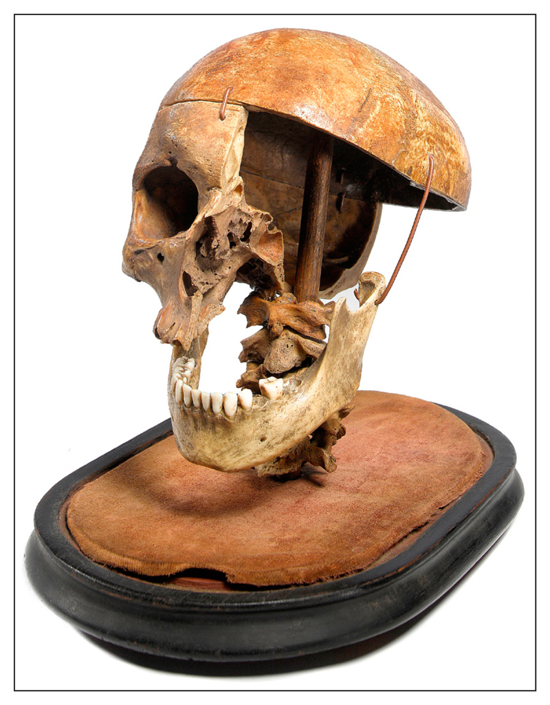 The Dark Value of Criminal Bodies: Context, Consent, and the Disturbing Sale of John Parker's Skull.