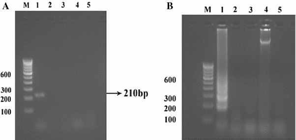 Rapid Detection of Avian Infectious Bronchitis Virus by Reverse Transcriptase-Loop Mediated Isothermal Amplification.