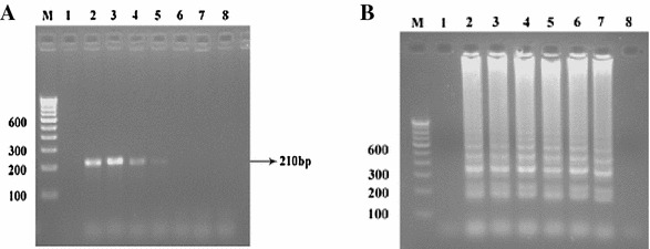 Rapid Detection of Avian Infectious Bronchitis Virus by Reverse Transcriptase-Loop Mediated Isothermal Amplification.