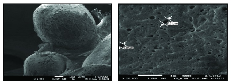 Formulation and evaluation of optimized oxybenzone microsponge gel for topical delivery.