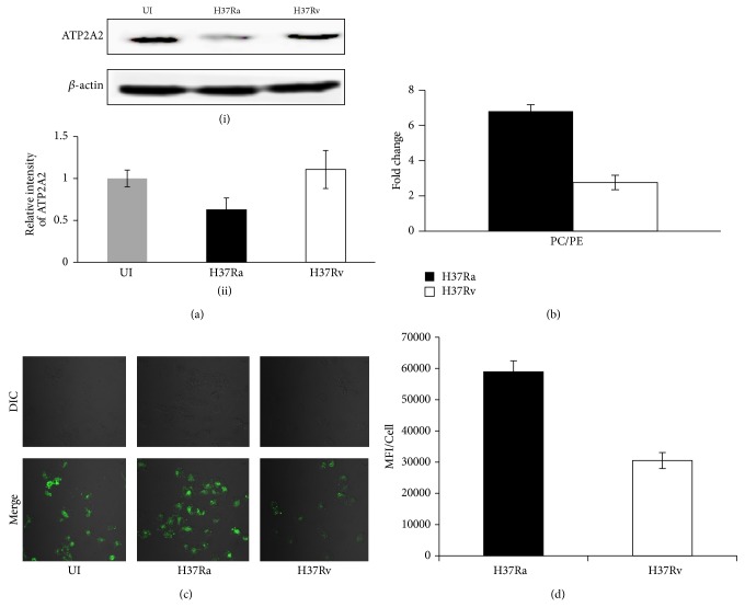 Quantitative Proteomics and Lipidomics Analysis of Endoplasmic Reticulum of Macrophage Infected with Mycobacterium tuberculosis.