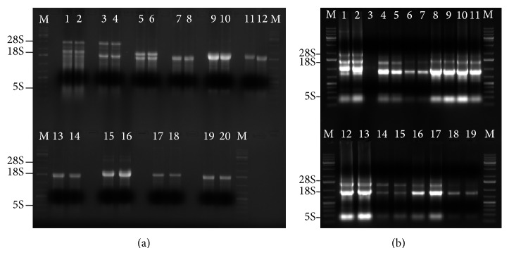 Insects' RNA Profiling Reveals Absence of "Hidden Break" in 28S Ribosomal RNA Molecule of Onion Thrips, Thrips tabaci.