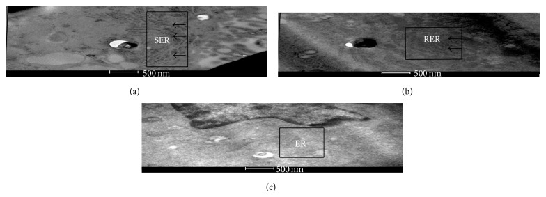 Quantitative Proteomics and Lipidomics Analysis of Endoplasmic Reticulum of Macrophage Infected with Mycobacterium tuberculosis.