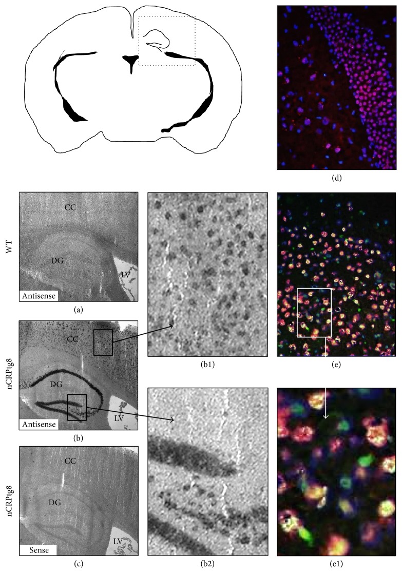 Hepatic but Not CNS-Expressed Human C-Reactive Protein Inhibits Experimental Autoimmune Encephalomyelitis in Transgenic Mice.