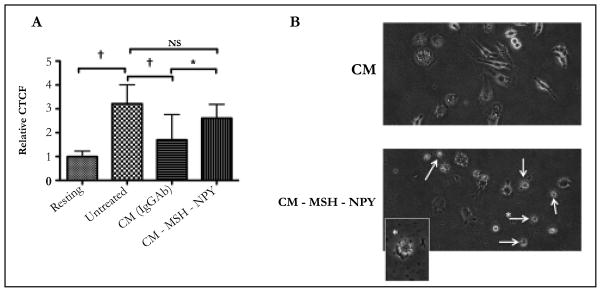 Retinal Pigment Epithelial Cell Line Suppression of Phagolysosome Activation.