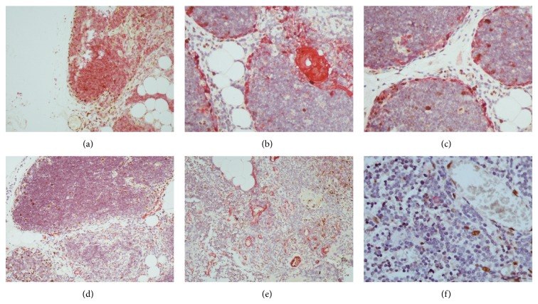Immunohistological analysis of the jun family and the signal transducers and activators of transcription in thymus.