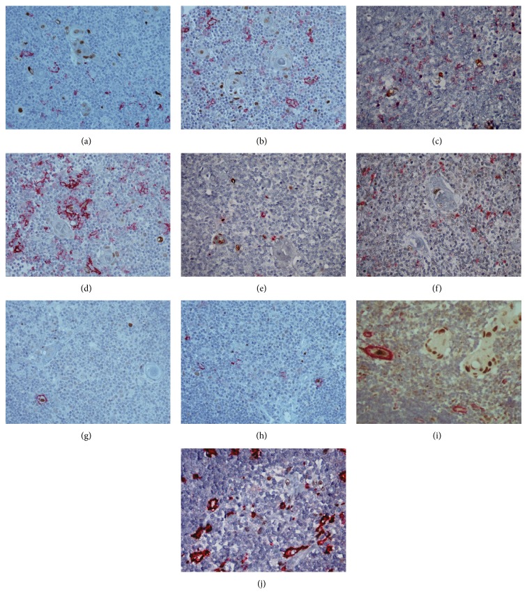 Immunohistological analysis of the jun family and the signal transducers and activators of transcription in thymus.