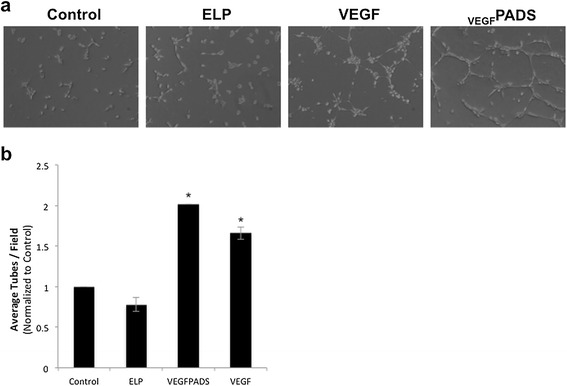 Growth factor purification and delivery systems (PADS) for therapeutic angiogenesis.