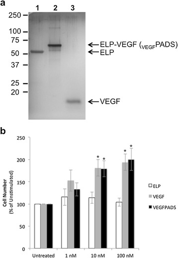 Growth factor purification and delivery systems (PADS) for therapeutic angiogenesis.