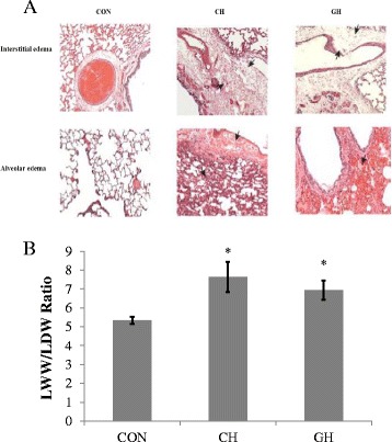 Hypoxia mediated pulmonary edema: potential influence of oxidative stress, sympathetic activation and cerebral blood flow.