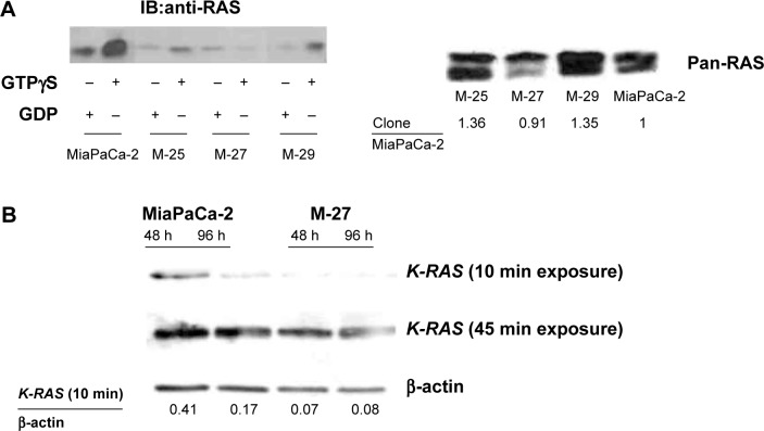 Mutant K-RAS Promotes Invasion and Metastasis in Pancreatic Cancer Through GTPase Signaling Pathways.