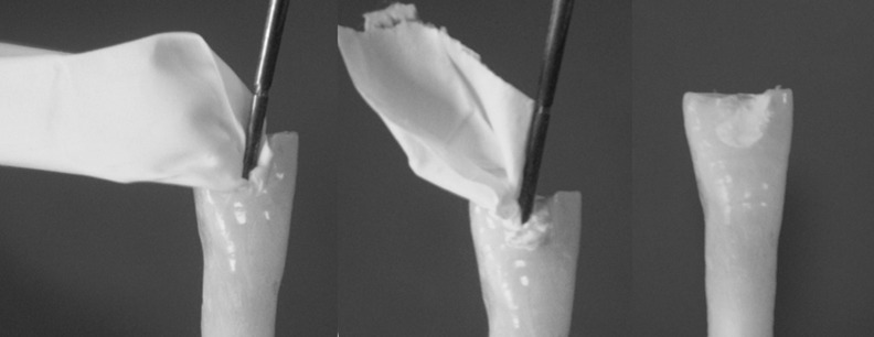 Polytetrafluoroetylene tape as temporary restorative material: a fluid filtration study.