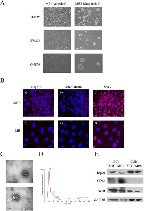 Proteomic analysis of extracellular vesicles from medullospheres reveals a role for iron in the cancer progression of medulloblastoma.